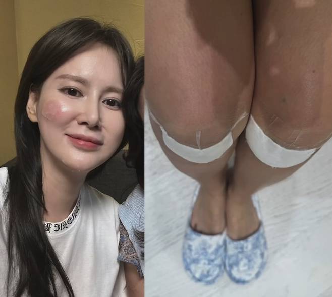 사진=이혜원 SNS