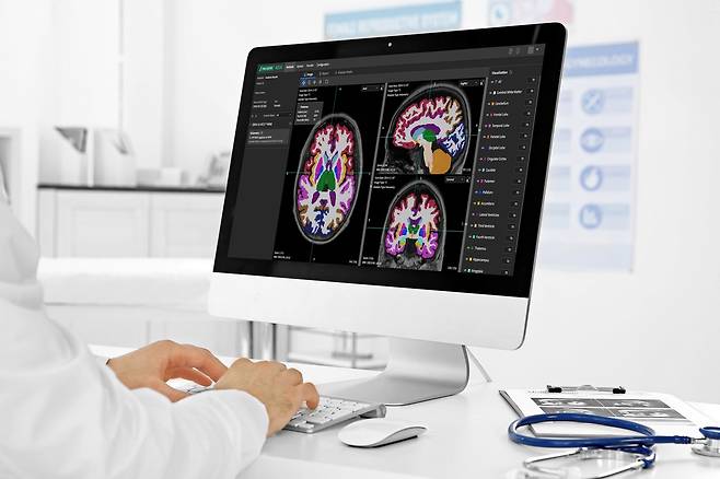 AI 진단 솔루션 '뉴로핏 아쿠아' 활용 모습.(뉴로핏 제공)/뉴스1