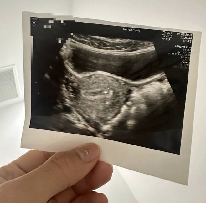 An ultrasound scan after Sohan received a male embryo at a Thai clinic [SOHAN]