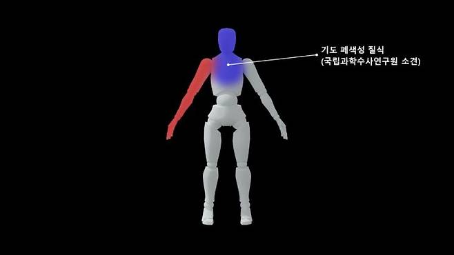 국립과학수사연구원의 부검에 따르면 2022년 10월14일 경기 평택시 SPL 공장의 '소스 배합기'에서 작업하다가 사망한 박모씨(23·여)는 기도 폐색성 질식으로 사망했다. 폐 내부에서 이물질이 발견됐고 머리와 뇌 손상은 없었다. 스튜디오 우타