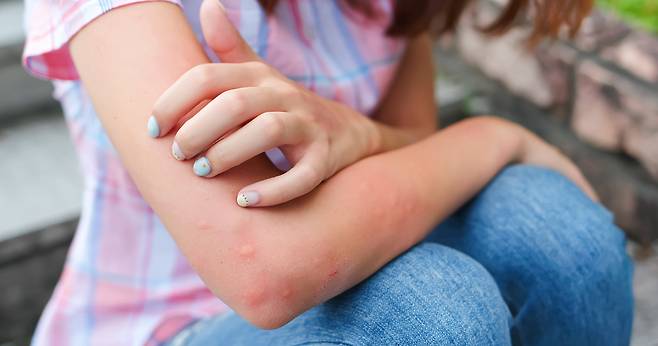 맥주를 마신 사람이 모기에 더 잘 물린다는 연구 결과 발표됐다. 클립아트코리아 제공