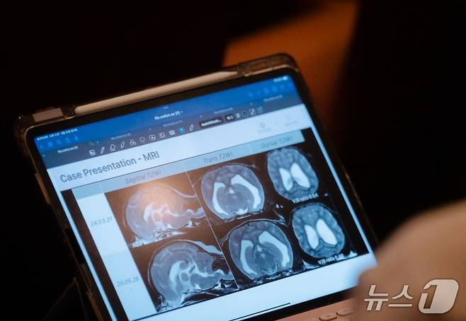 14일 열린 '제2회 벳아너스 증례 교류 심포지엄(CES)'에서 한 참석자가 MRI 발표 자료를 보고 있다(벳아너스 제공). ⓒ 뉴스1