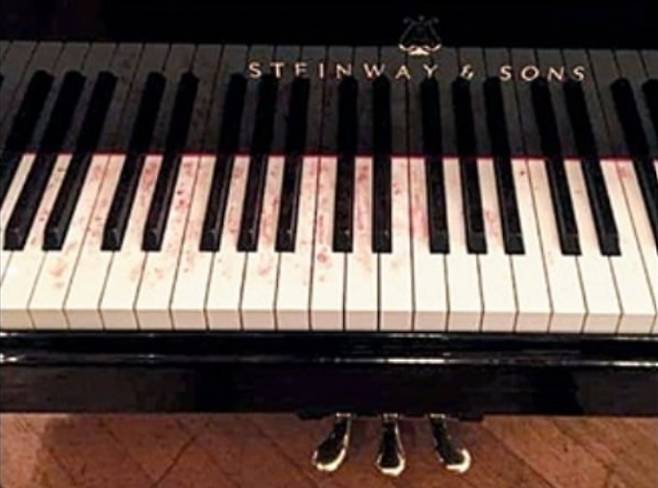 2015년 10월 오스트리아 빈 콘체르트하우스에서 피아니스트 예핌 브론프만이 런던 심포니 오케스트라와의 협연을 마친 뒤 찍은 피아노엔 피 얼룩이 그대로 남겨져 있었다. [slippedisc 캡처]