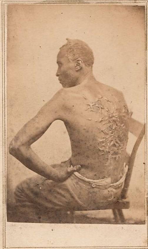 복제품 철거 지시를 받은  '채찍질 당한 등'(The Scourged Back) 사진. 노예에 대한 폭력을 적나라하게 보여주는 대표적인 사진이다. /메트로폴리탄 미술관