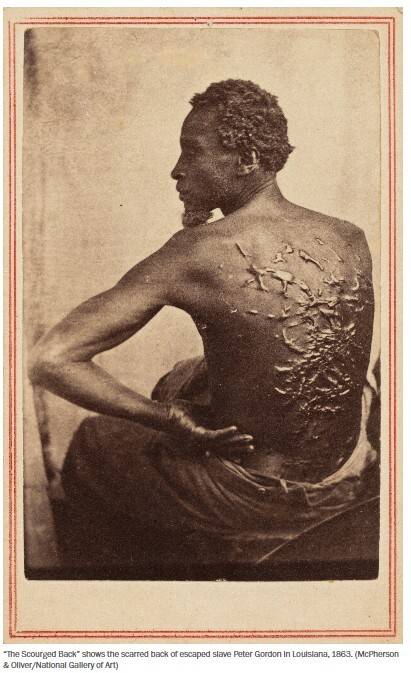 1863년 미국 루이지애나주에서 도망친 노예 피터 고든의 등에 남은 상처를 보여주는 사진 ‘채찍질 당한 등’. 사진=미국 국립미술관 워싱턴포스트 캡처