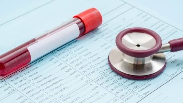 건강검진 결과, 간 수치가 높게 나왔다면 UDCA가 도움 될 수 있다｜출처: 클립아트코리아