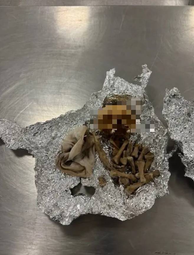 미국 플로리다주의 탬파 국제공항 세관국경보호국(CBP)이 적발한 사람의 것으로 추정되는 두개골과 뼈. /뉴욕포스트