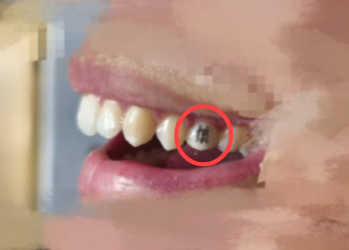 중국의 한 네티즌이 공개한 '치아 문신'. 연합뉴스