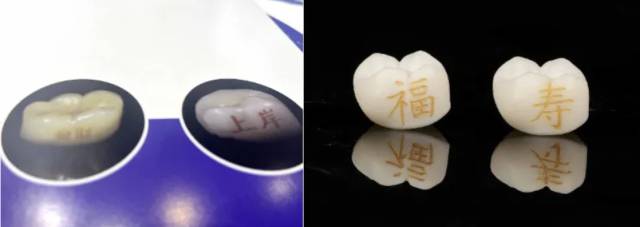 치아에 글씨를 새긴 ‘치아 문신’. 연합뉴스