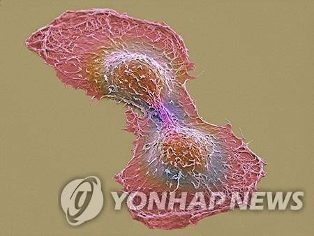 암세포 두 개의 전자현미경 영상 이미지 [ UCSD NCMIR 토마스 데링크 제공]