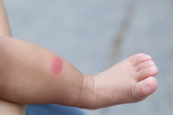 사진은 기사 내용과 직접적인 관련이 없음. 사진=게티이미지뱅크