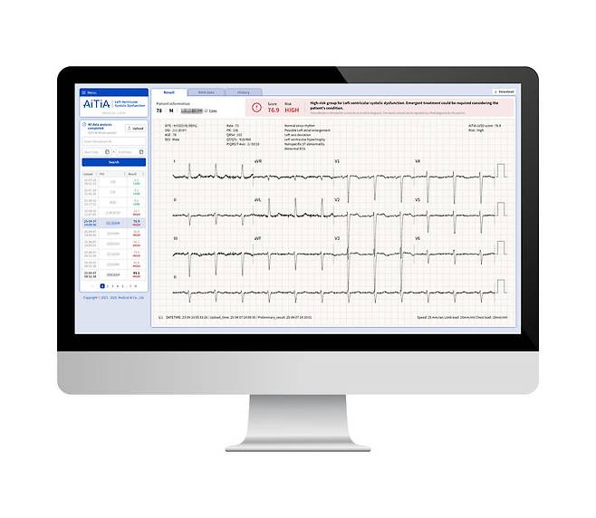 [서울=뉴시스] 2일 메디컬에이아이는 자사가  보유한 '심전도 분석 인공지능 알고리즘을 활용한 심장질환 진단 기술'을 국가전략기술로 확인했다.고 밝혔다. (사진=메디컬에이아이 제공) 2025.10.02. photo@newsis.com *재판매 및 DB 금지