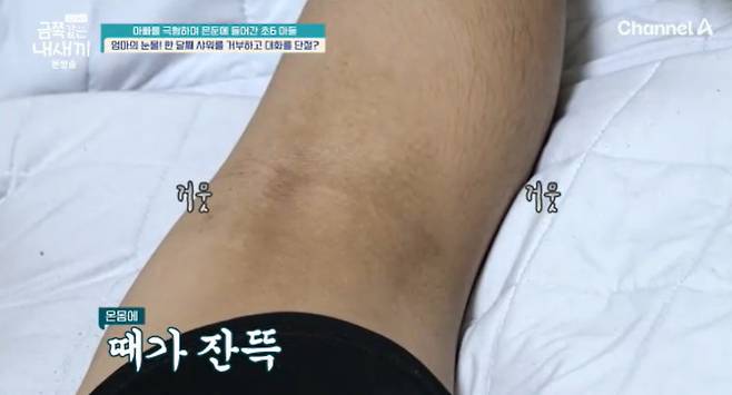 채널A ‘요즘 육아 - 금쪽같은 내 새끼’