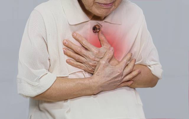 기사 이해를 돕기 위한 사진. 클립아트코리아