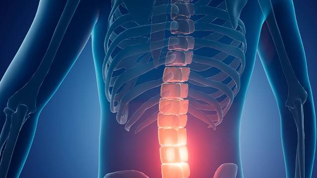 신경차단술은 디스크 탈출증, 척추관 협착증과 같은 만성 통증에 효과적이다｜출처:&nbsp;클립아트코리아