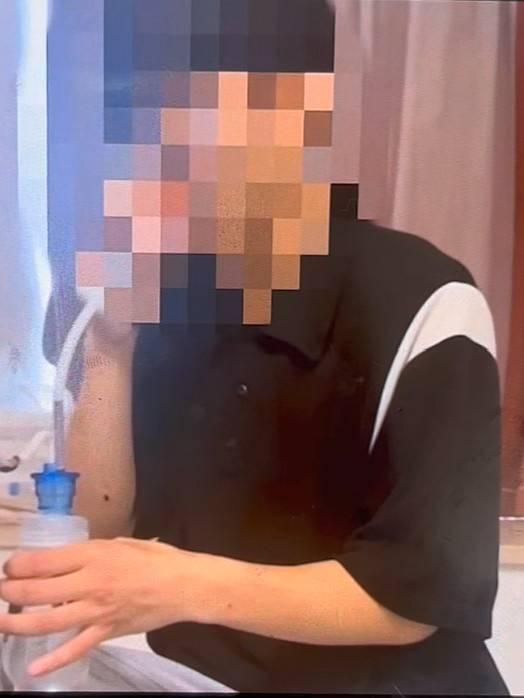 캄보디아에서 범죄조직의 고문에 의해 숨진 경북 출신 대학생 추정 모습. 사진 텔레그램 '범죄와의 전쟁2' 채널 캡처