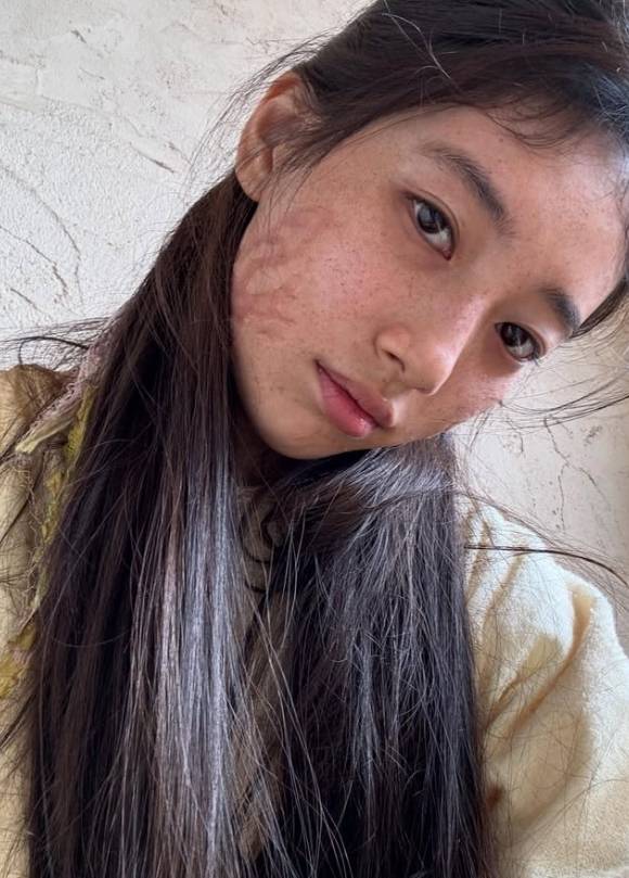 수지 소셜 미디어