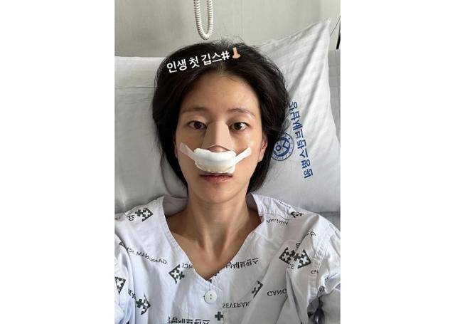 모델 겸 방송인 이현이가 축구 경기 도중 코뼈가 부러지는 부상을 입어 팬들의 우려를 자아냈다. 이현이 SNS