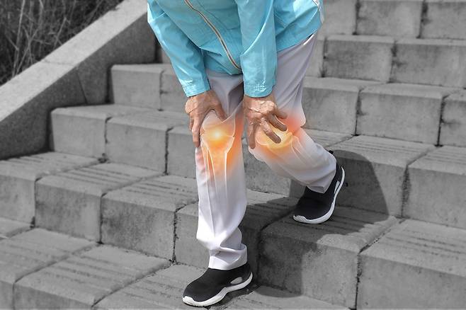 관절을 보호하고 있는 연골의 손상이나 퇴행성 변화로 인해 관절을 이루는 뼈와 인대 등에 손상이 생겨 염증과 통증이 발생｜출처: 클립아트코리아