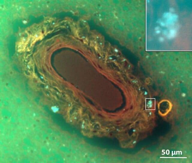 뇌 피질하 백질에 있는 혈관의 모습. 청록색 점은 플라스틱 입자를 나타낸다. (출처=미국 뉴멕시코 대학)