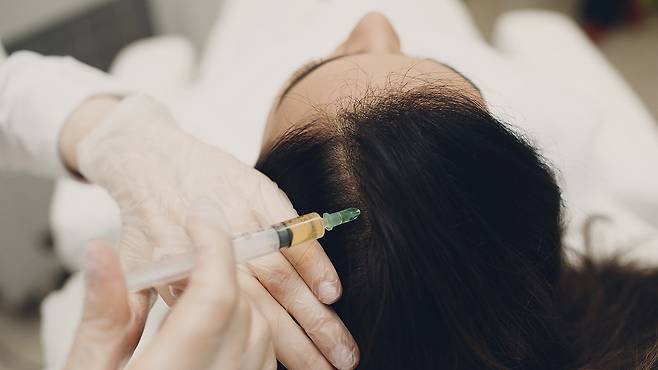 줄기세포 탈모 치료는 성장인자를 두피에 주입해 모낭세포를 활성화한다｜출처: 클립아트코리아