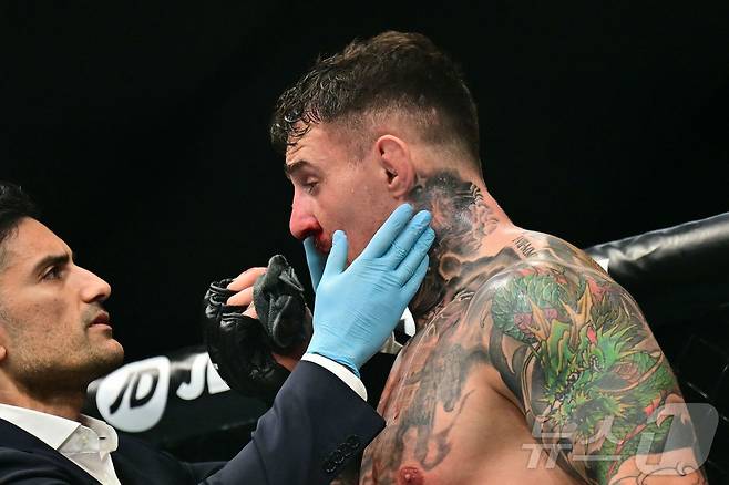 눈을 찔린 뒤 의료진의 체크를 받는 아스피날.ⓒ AFP=뉴스1