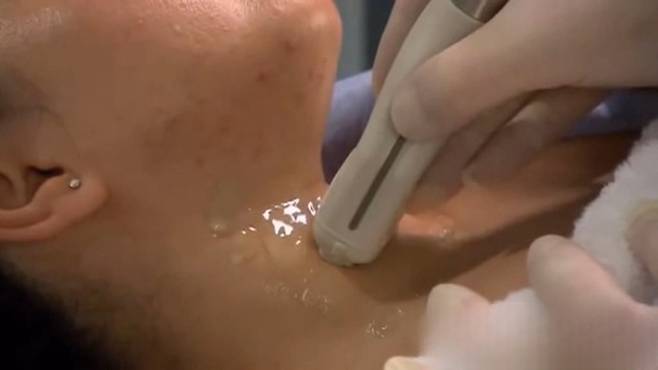 갑상선 검진 사진=연합뉴스TV&nbsp;