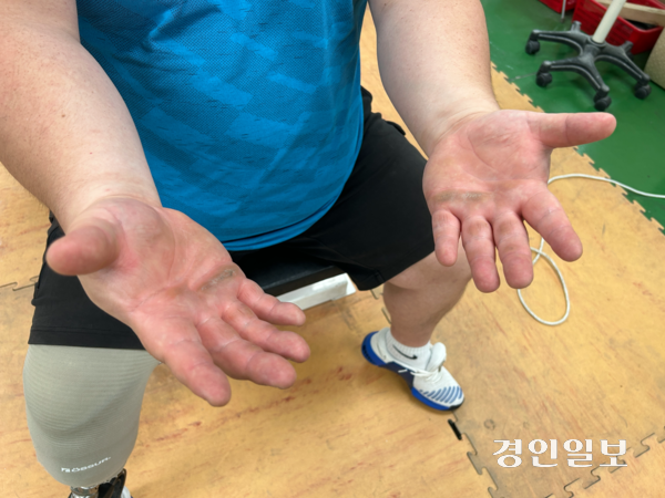 7일 오전 인천시 장애인역도팀 훈련장에서 만난 전나라수 선수의 손에 굳은 살이 박혀 있다. 2025.11.7/백효은기자100@kyeongin.com