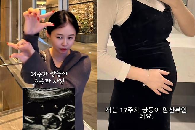 배우 오초희가 노산과 관련해 쏟아지는 편견을 언급하며 응원을 부탁했다. 오초희 인스타그램 캡처