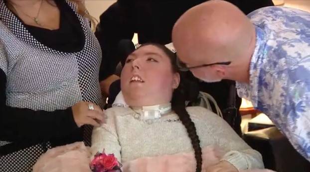 희귀 질환 ‘무뇌증’을 지닌 20세 여성, 앨릭스 심슨 [뉴욕포스트]