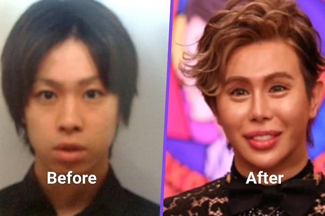 어린 시절 집단 괴롭힘 피해를 봤던 일본의 한 남성이 1억엔(약 9억5000만원)을 들여 전신 성형한 뒤 인플루언서로 성공했다. /사진=홍콩 사우스차이나모닝포스트(SCMP) 캡처