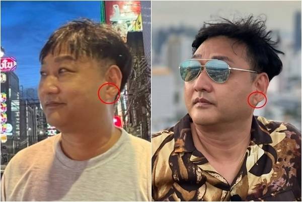 개그맨 김수용(59)이 유튜브 촬영 중 갑작스럽게 의식을 잃고 쓰러져 병원으로 긴급 이송된 후 회복 중인 가운데, 그의 귓불에 있던 선명한 사선 주름이 전조 증상이었다는 주장이 제기됐다. 김수용 인스타그램 캡처