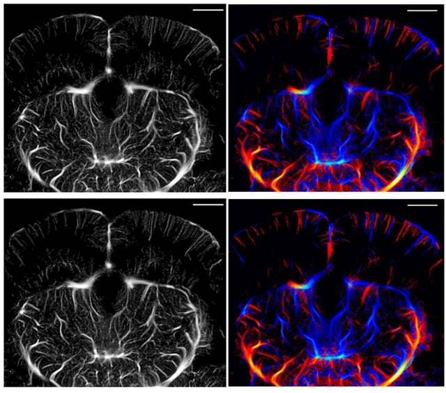 기존 초음파 국소화 현미경(ULM)으로 획득한 쥐 뇌의 모세혈관 영상(위쪽)과 ULM의 효율성을 높여 개발한 ‘ULM-Lite’로 획득한 모세혈관 영상(아래쪽). DGIST 제공.