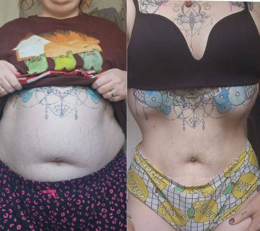 임신한 것으로 오해까지 받았던 영국의 한 30대 여성이 약 60kg 감량에 성공한 사례를 공개해 화제다./사진=니드투노우