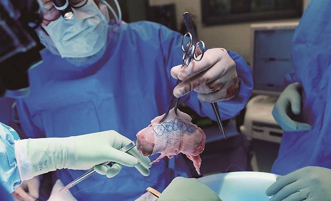 의사가 이식 수술 도중에 면역 거부반응이 없도록 유전자 교정을 거친 돼지 신장을 들고 있다. /사진 미국 뉴욕대 랑곤병원