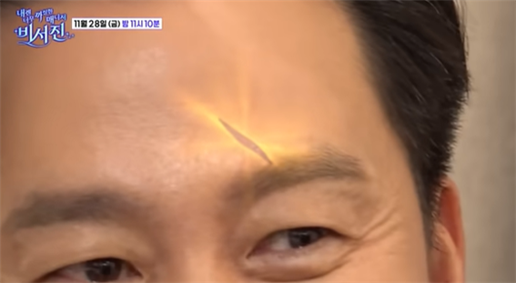 애니 집에서 얼굴에 흉터 생긴 이서진. SBS