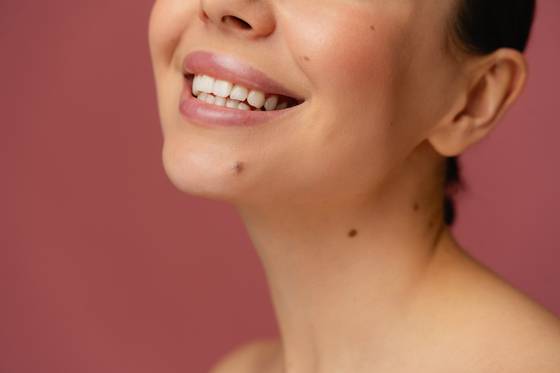 A close-up of a woman’s moles, a feature often interpreted with specific meanings in Korean physiognomy. [GETTY IMAGES BANK]