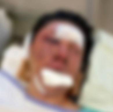 유튜버 수탉 입원 당시 모습. 숲 라이브 방송 캡처