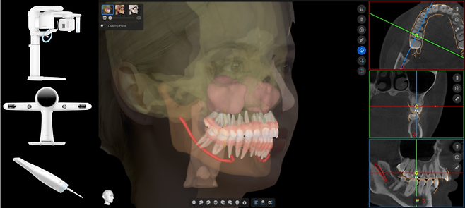 *5D 솔루션. (이미지=레이)