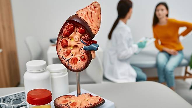 요로결석은 신장·요관·방광·요도에 단단한 돌이 생기는 질환이다｜출처: 클립아트코리아