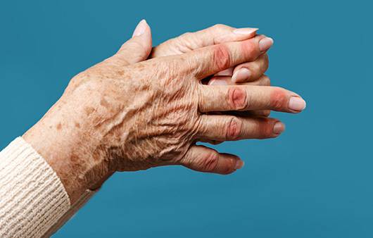 디지털 기기 사용이 늘면서 ‘손 노화’는 더 빨라지고 있다. 게티이미지