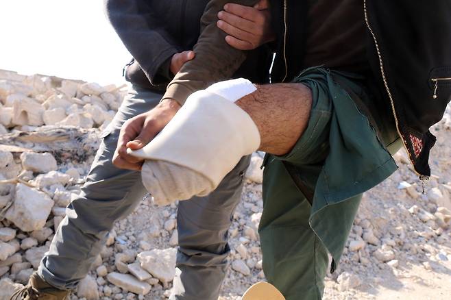 내전 끝난 뒤에도 위험 여전 (하라스타=연합뉴스) 김동호 특파원 = 4일(현지시간) 13여년의 내전으로 폐허가 된 시리아 다마스쿠스 인근 하라스타의 한 주민이 다리 상처를 보이고 있다. 2025.12.4 dk@yna.co.k