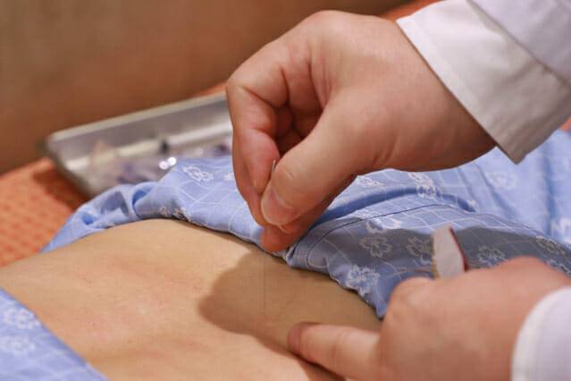 의료진이 허리디스크 침 치료를 진행하고 있다(제공=자생한방병원)