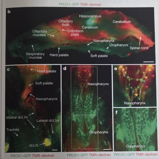 쥐 모델에서 확인한 뇌 림프 배출 경로. '네이처' 지에 실린  뇌 림프 관련 논문 중 사진.