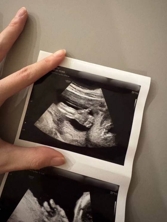 /사진=김소영 인스타그램 캡처