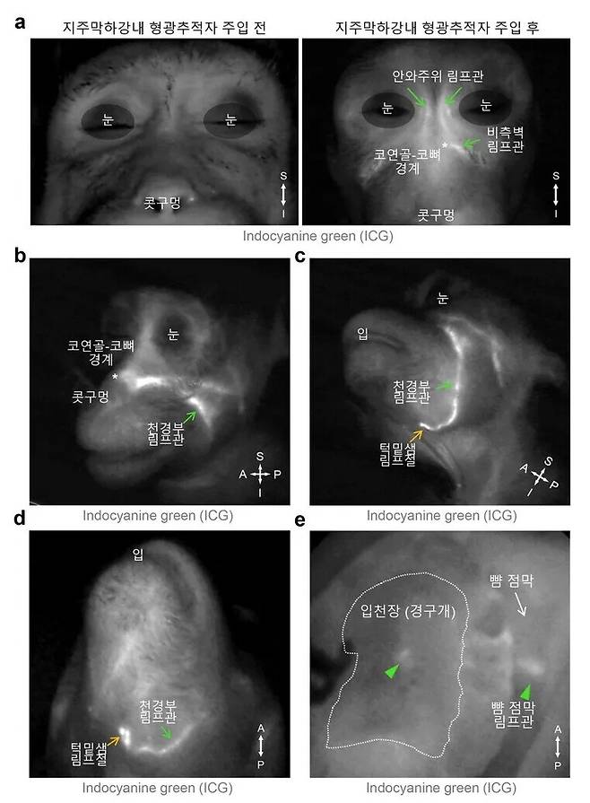 영장류에서 관찰된 뇌척수액 배출 림프관 분포. 뇌막에 주입된 뇌척수액 형광 물질이 눈 주위, 코 옆, 턱과 목 사이 림프관을 거쳐 턱밑샘 림프절에 쌓이는 모습이 확인됐다. 입천장과 뺨 안쪽 점막 림프관에서도 형광이 관찰돼 생쥐 실험 결과와 일치한다. 기초과학연구원 제공