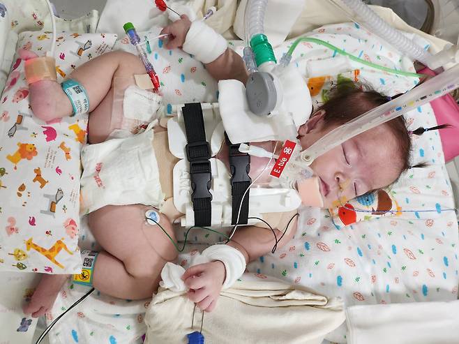 Eight-month-old Park Seo-rin, who underwent multiple surgeries for an exposed heart, rests at Seoul Asan Medical Center. [SEOUL ASAN MEDICAL CENTER]