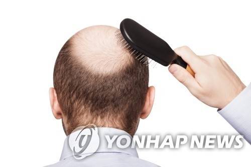 [연합뉴스]