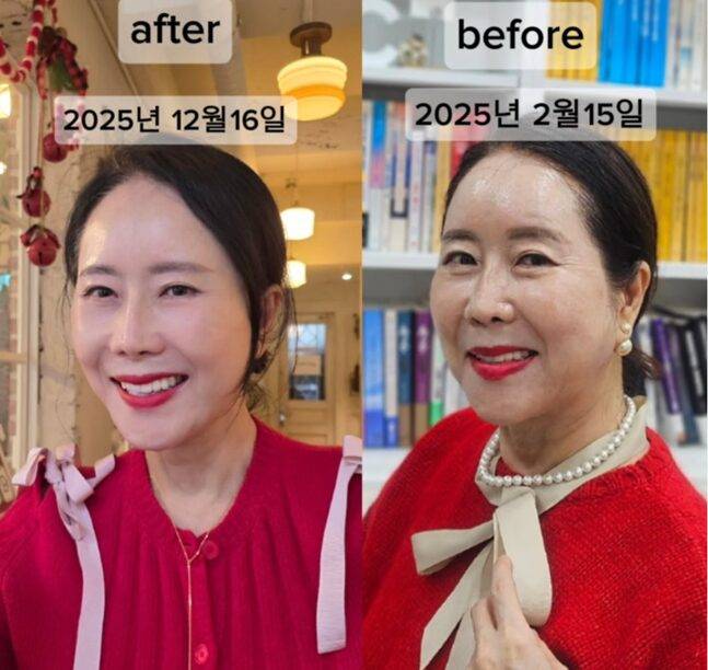 윤영미가 공개한 비포 앤드 애프터(왼쪽). 놀랍도록 젊고 예뻐진 얼굴로 시선을 집중시켰다. 사진=윤영미 SNS