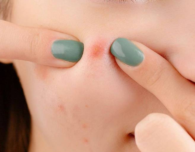 사진은 기사의 직접적인 내용과는 무관한 이미지. 펙셀스